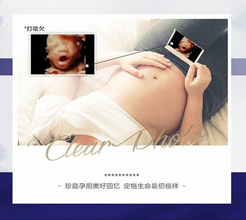 四维彩超是否需要空腹？